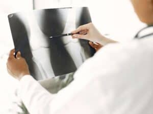 הסבר פשוט למעמד הפטור